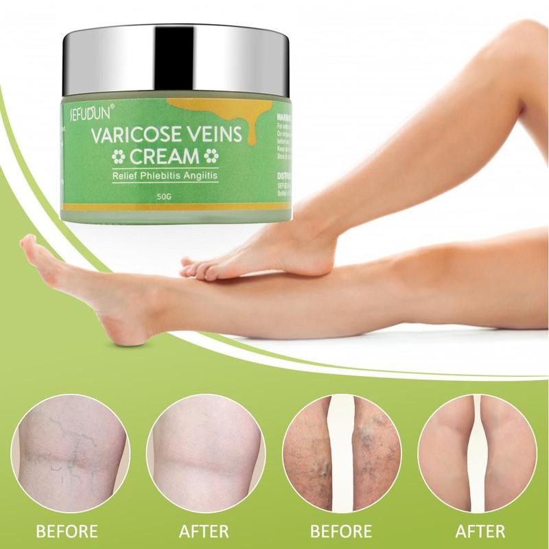 Varicose Veins Massage Cream